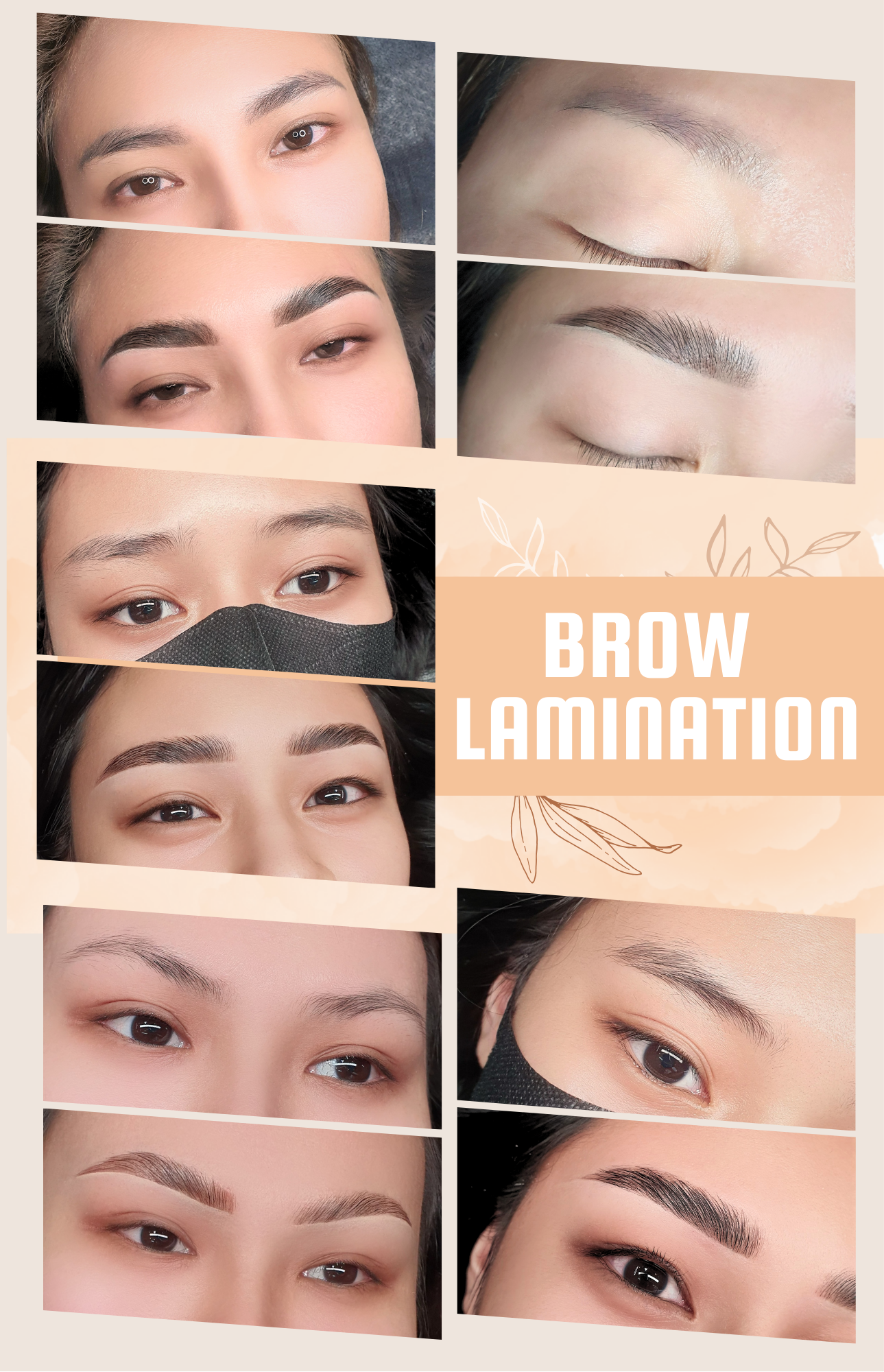 ตัวอย่างผลงาน Brow Lifting